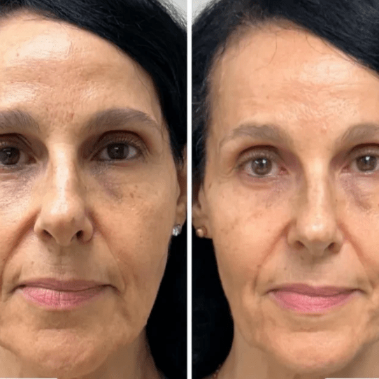 Máscara Coreana de Colágeno Rejuvenescedora Peel Off - Collagen Fit™